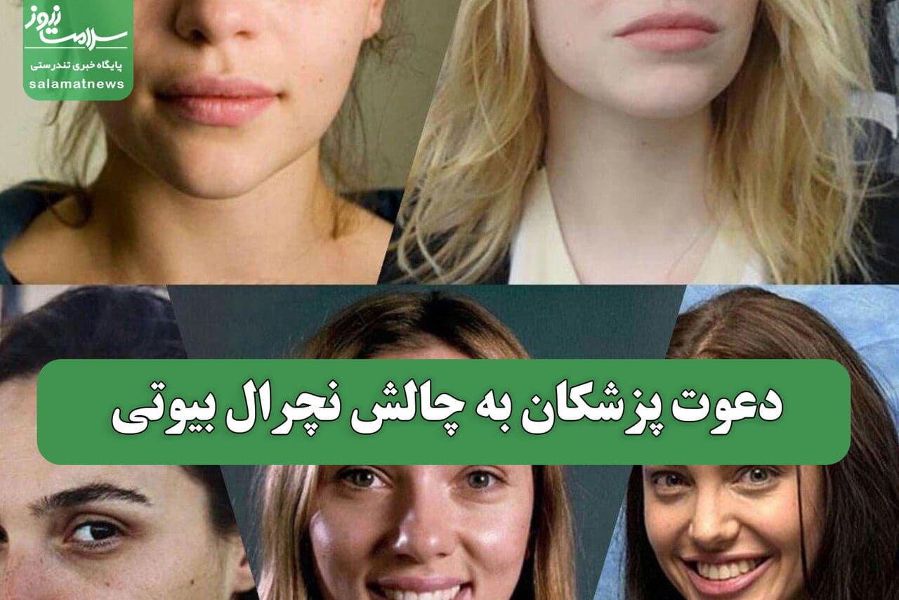 تصویر خبر: دعوت پزشکان به چالش نچرال بیوتی